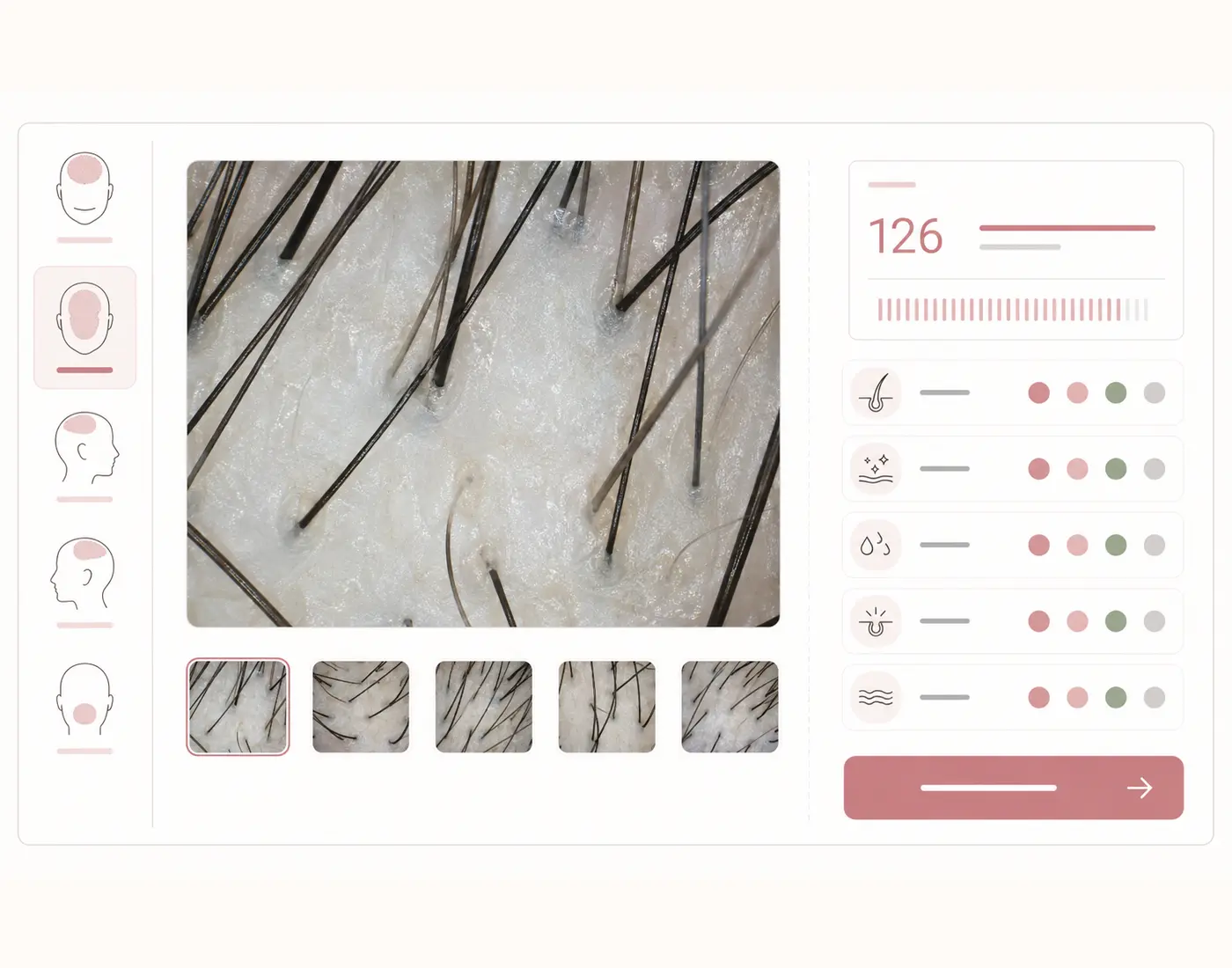 SCALP NOTEの5部位撮影と頭皮コンディション入力画面